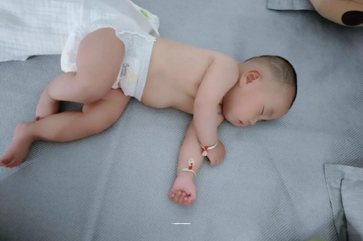 贵阳六个月宝宝眼睛散光
